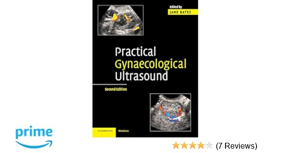 Refine your editions: